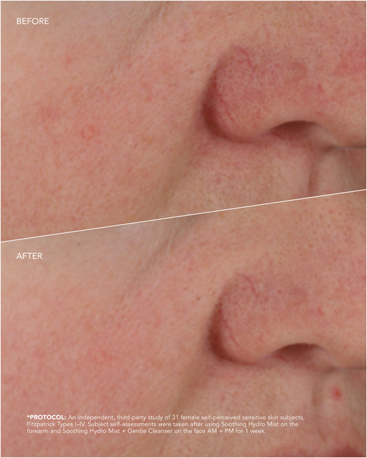 ZO Soothing Hydro Mist